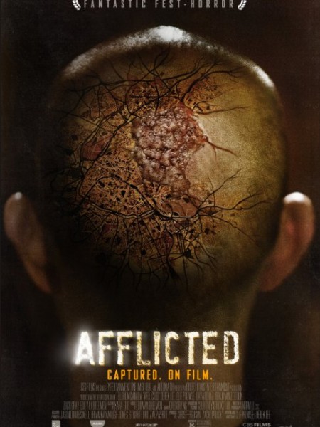 Sức mạnh dị thường, Afflicted (2013)