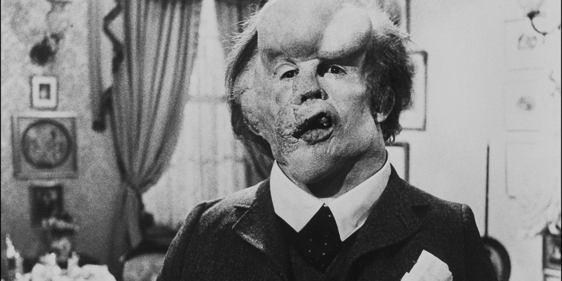 The Elephant Man / The Elephant Man (1980)