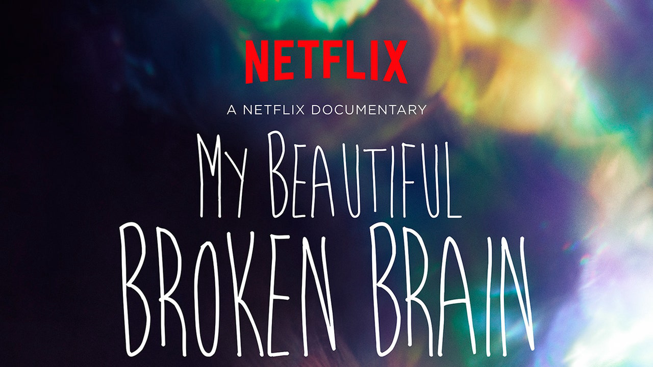 Xem Phim Khối óc xinh đẹp tội nghiệp của tôi, My Beautiful Broken Brain 2016