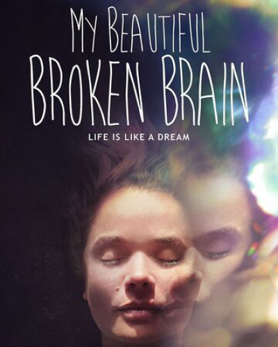 Khối óc xinh đẹp tội nghiệp của tôi, My Beautiful Broken Brain / My Beautiful Broken Brain (2016)